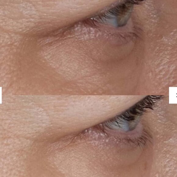 Perricone MD Vitamin C Ester CCC+ Brightening Under-Eye & Photo-Brightening DUO - Picture 5 of 11